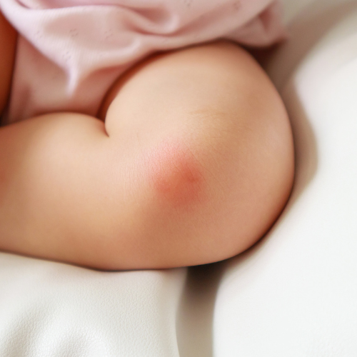 bebe et punaise de lit